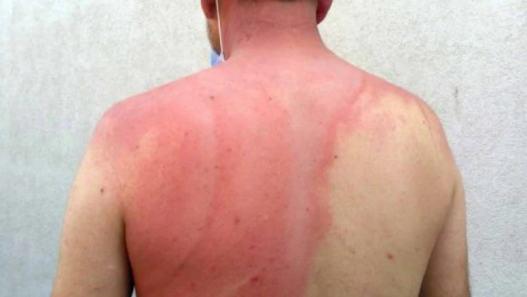 Komşusuna kaynar su döktü